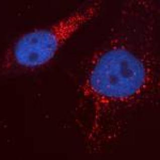 Fish cells infected pancreatic necrosis virus