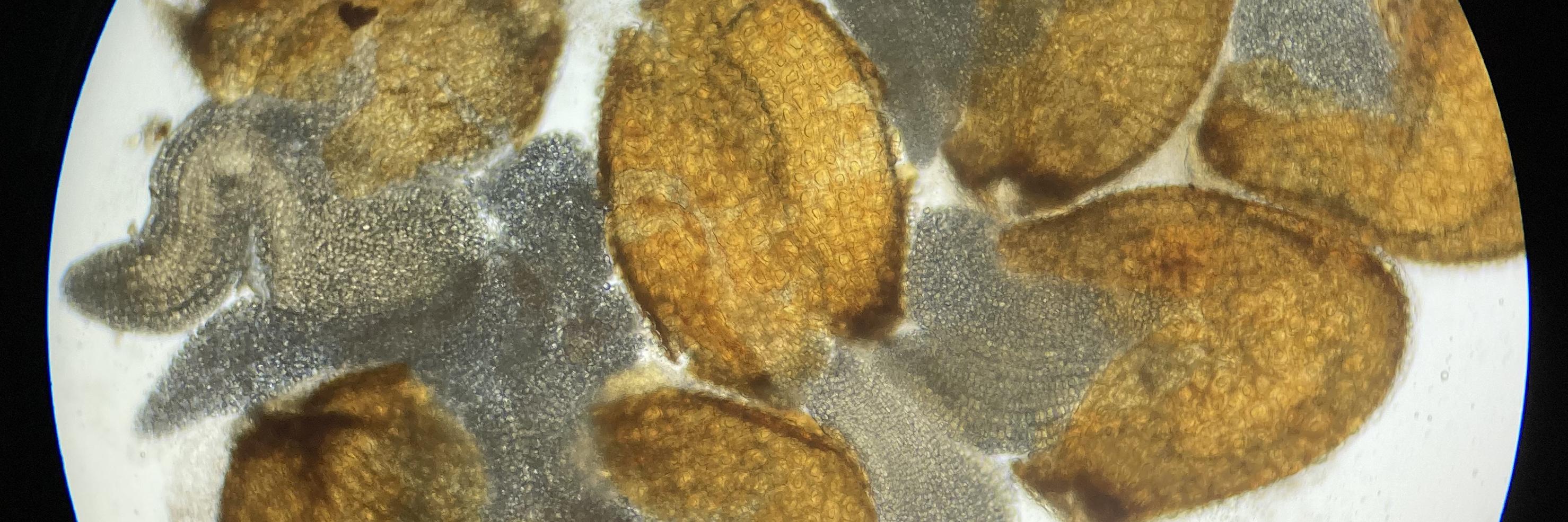 microscopic image of fungi spores 