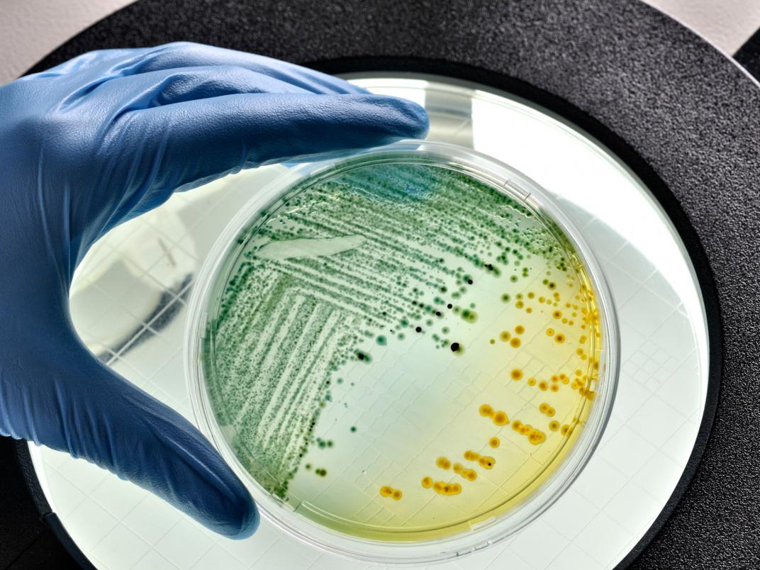 e_coli in a petri dish